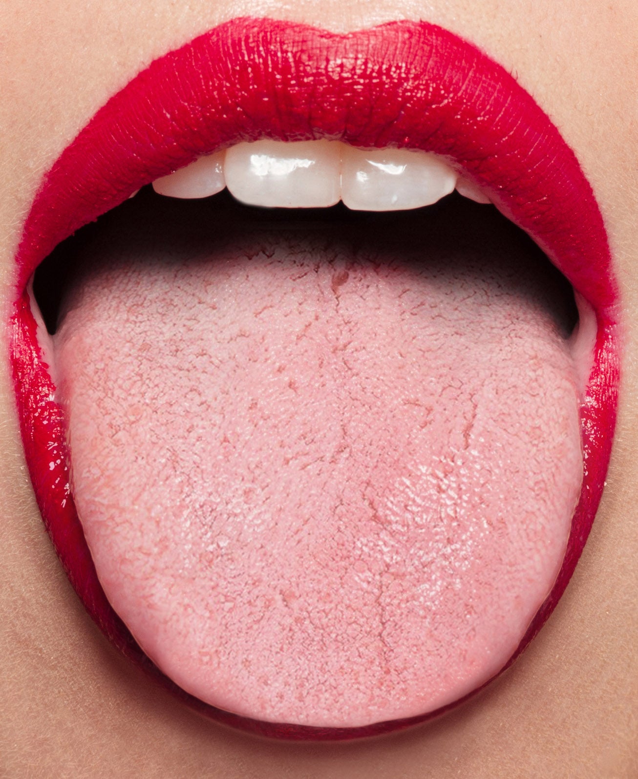 Tongue showing signs of white film/toxins